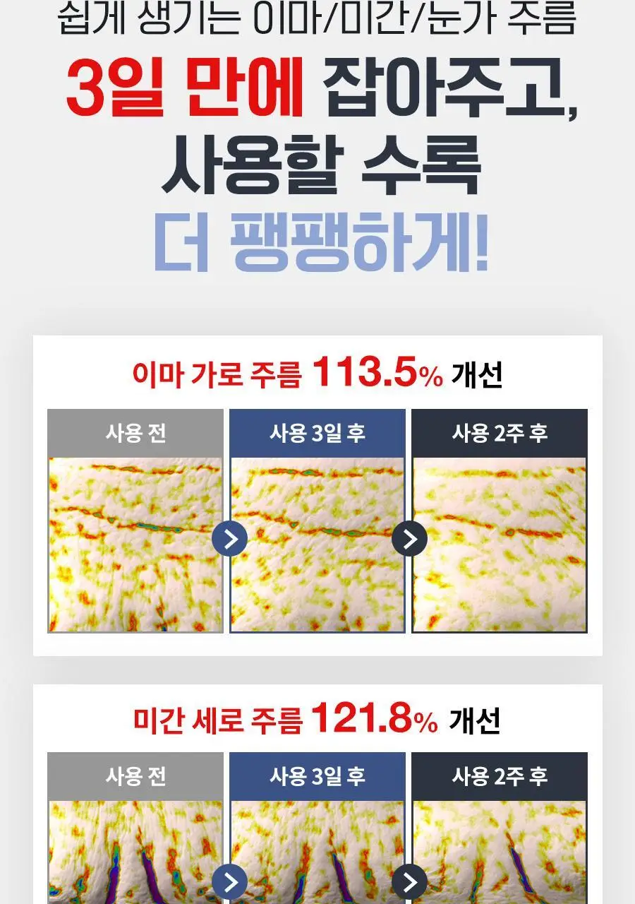 [리뉴얼/펩타이드/속보습] 닥터지 레드 블레미쉬 포 맨 탄력 올인원 2종 택 1 (단품/증정 기획) 상세페이지 18